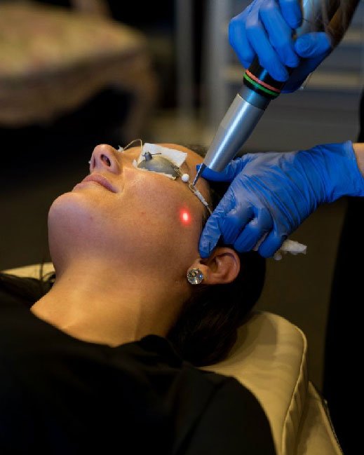 laser for pigmented lesions 03