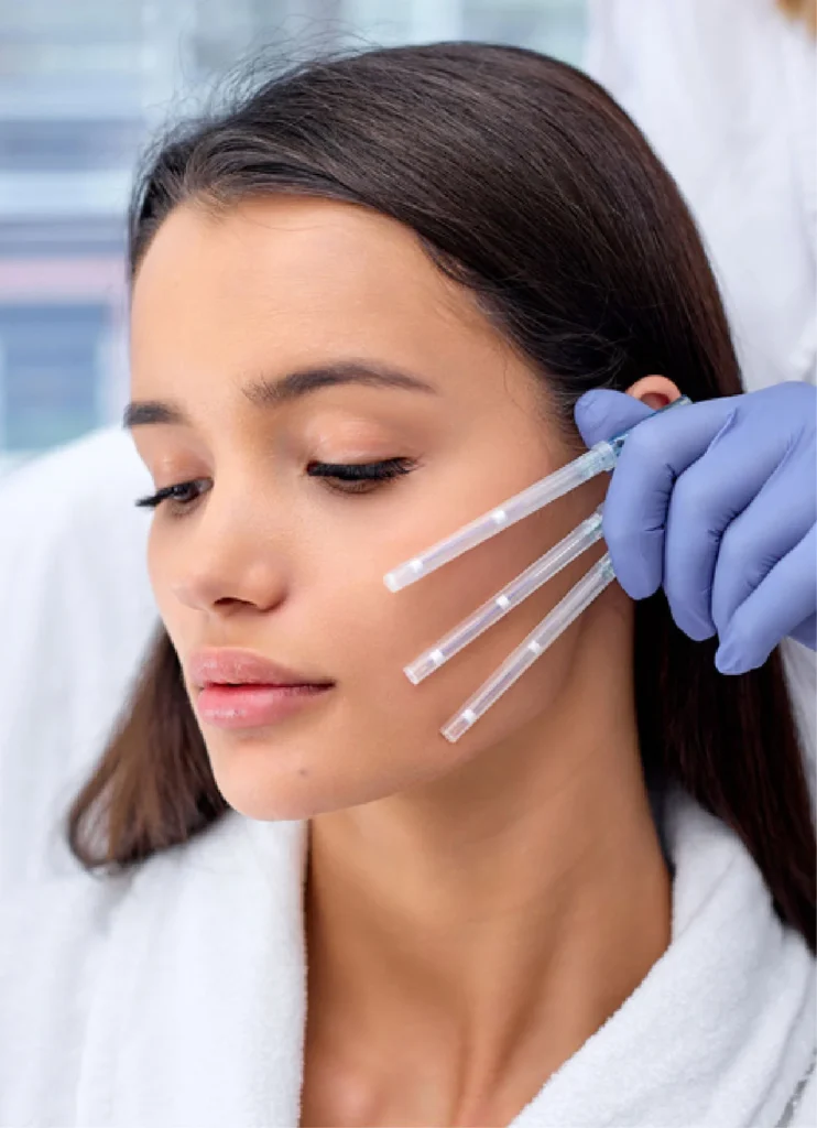 pdo-threads-treatment-in-lahore-ny-aesthetic